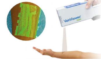 SSC_DVA3_IMG - VEINVIEWER.png